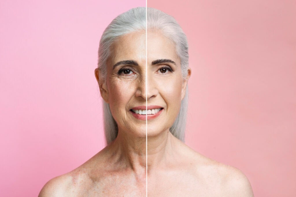 before-after-portrait-mature-woman-2