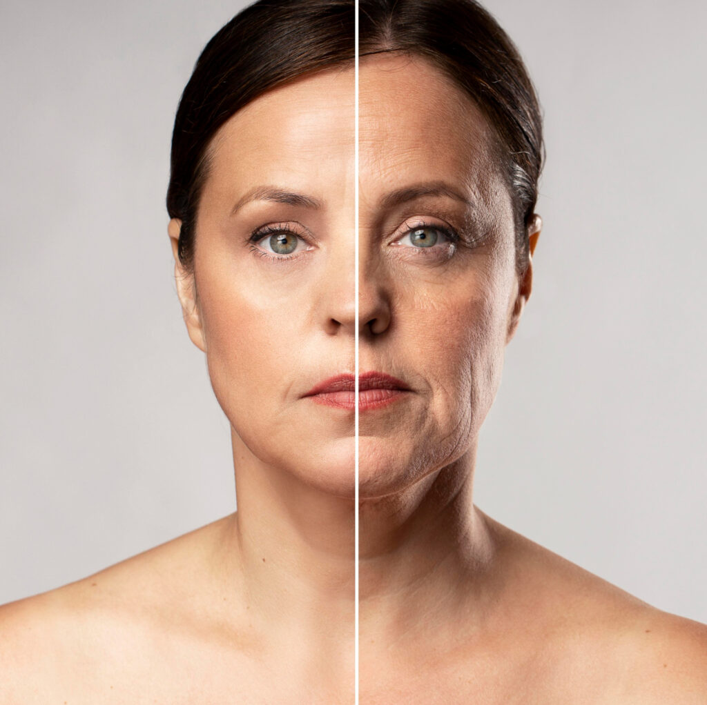 before-after-portrait-mature-woman-1