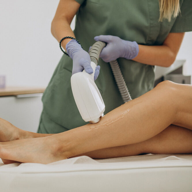 laser-epilation-hair-removal