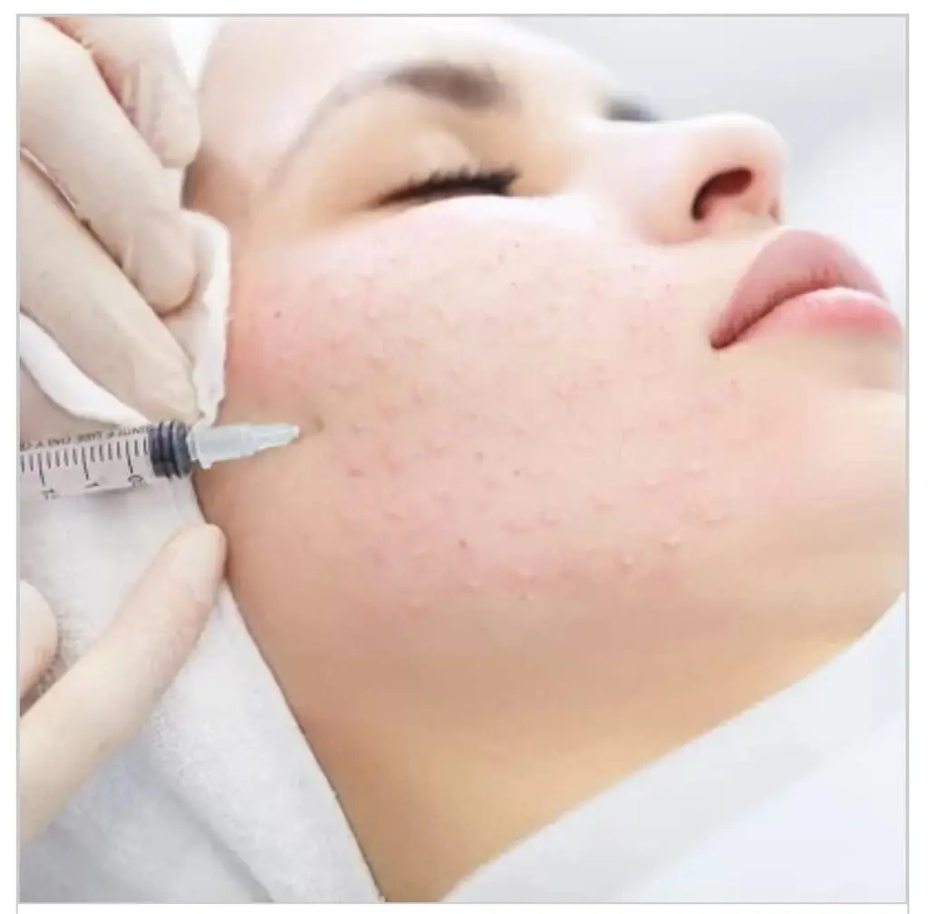 Mesotherapy